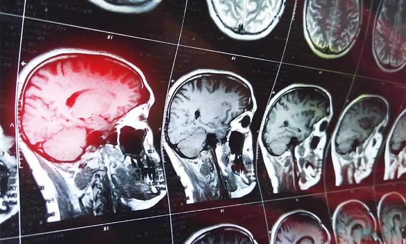 TikTokスカルブレイカーチャレンジ