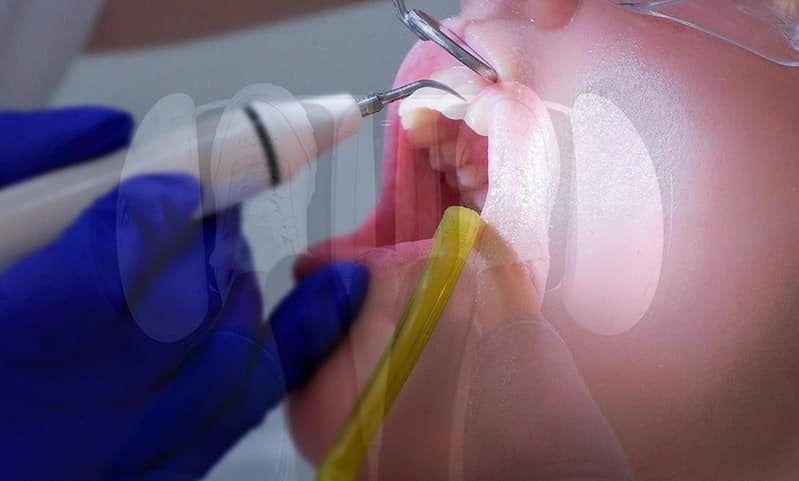 dentista hoverboard prisión