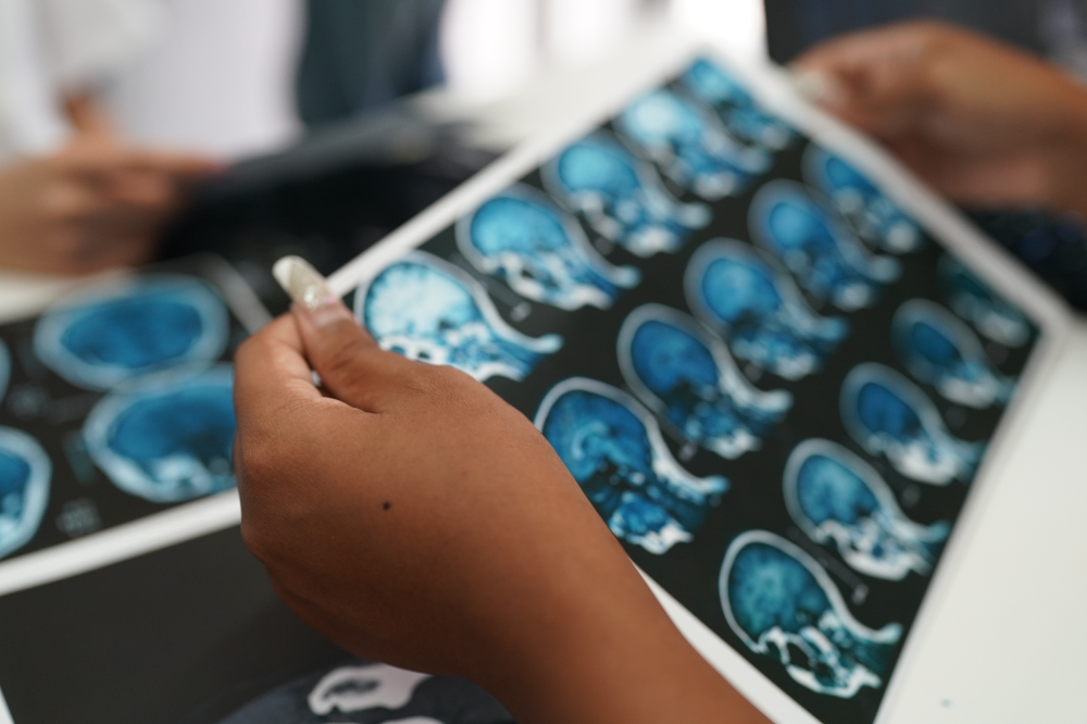 brain injury lawyer in New York